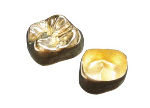 ゴールドクラウン